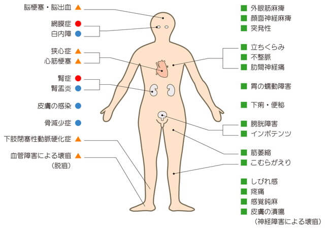 糖尿病の初期症状