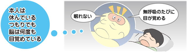 睡眠時無呼吸症候群とは？