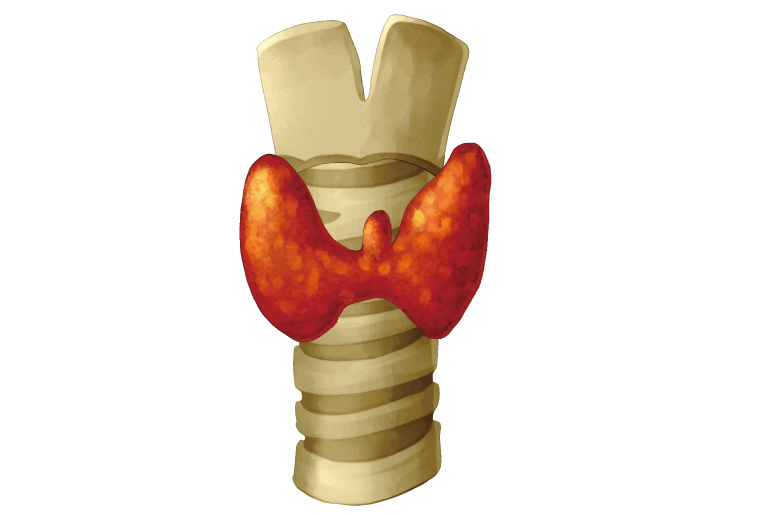 甲状腺の95％は良性のしこり